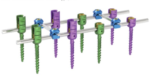 Система для транспедикулярної фіксації хребта (10 гвинтів) Джінлу